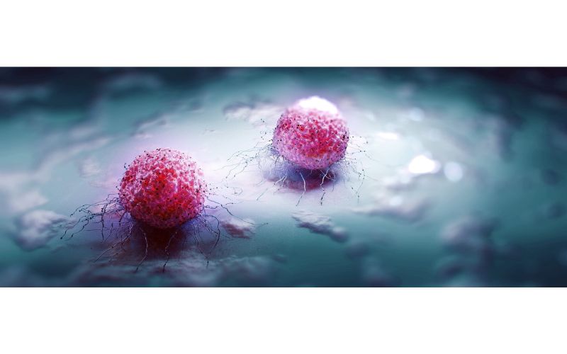 New 2025 Study: Whole-Body Electromyostimulation(WB-EMS) as a Promising Training Method for Cancer Patients