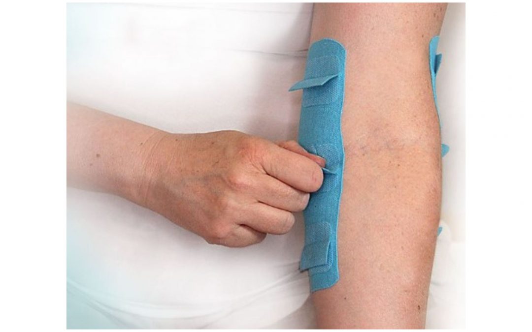 6D Tape – Clinical Applications: Pain, Swelling & Scar Management